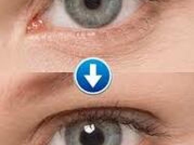Get Super HD Invisible Contact Lens for Playing Cards Available with Best Price - Delhi - 1